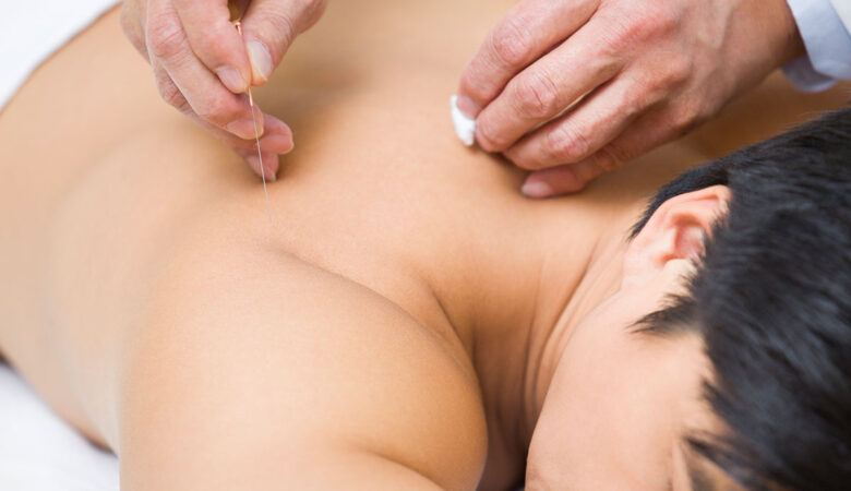 Alwise Holistic Clinic – The Best Acupuncture Clinic in Chennai for Natural Healing