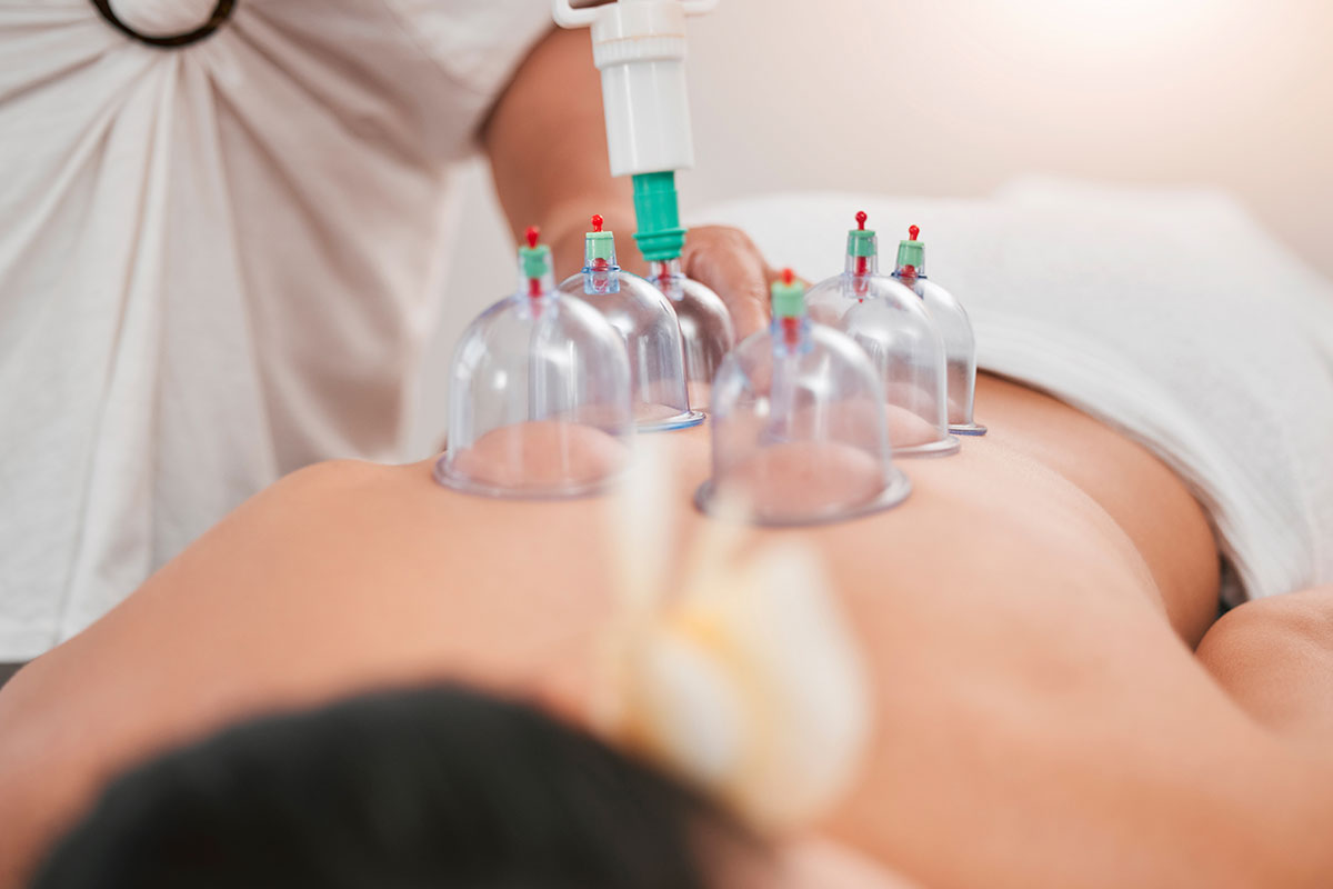 Hijama Therapy in Chennai