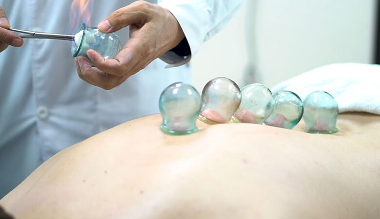 Experience Fire Cupping Therapy in Chennai – Alwise Holistic Clinic