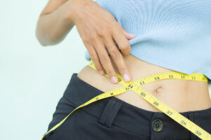 Naturopathy Treatment for Weight Loss in Chennai